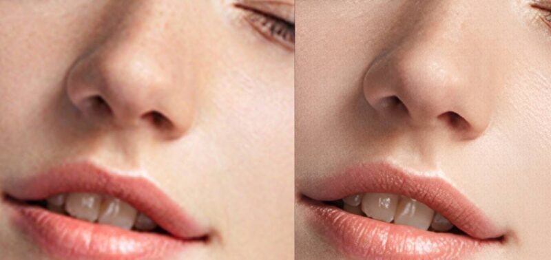 Пример Aiarty Image Enhancer Lips